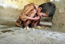 Starving Iraqi Child